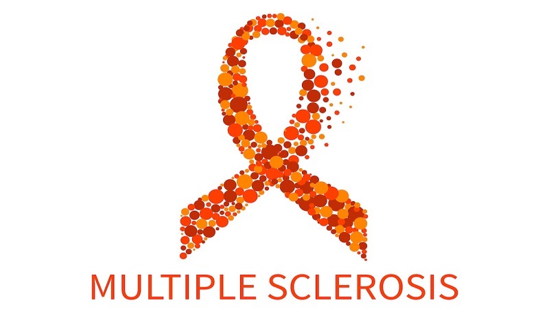 این افراد در خطر ابتلا به ام اس قرار دارند